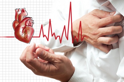 Mối liên hệ giữa bệnh cao huyết áp và bệnh tim mạch 