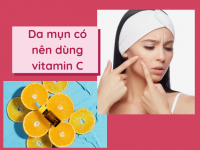 da mụn có nên dùng vitamin c